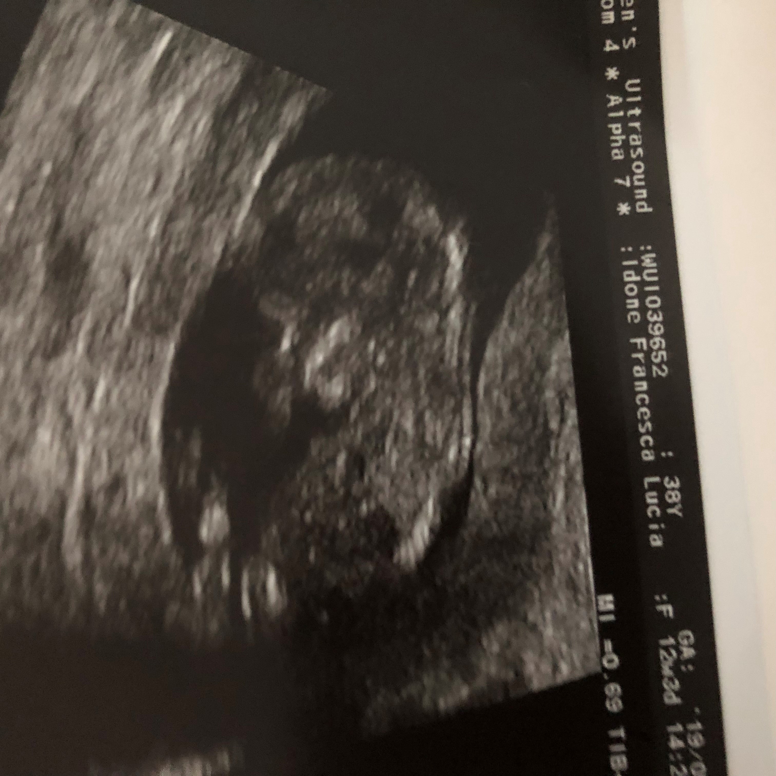 Name:  baby.jpg
Views: 104
Size:  1.52 MB