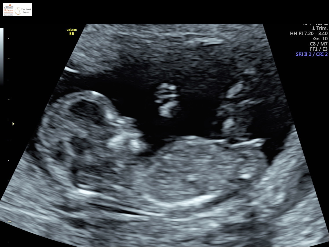 Name:  profile3.jpg
Views: 178
Size:  148.3 KB