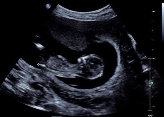 Name:  76644FAB-0CA5-4BD8-9A8A-2CC6B10D3BD5.jpeg
Views: 557
Size:  38.7 KB