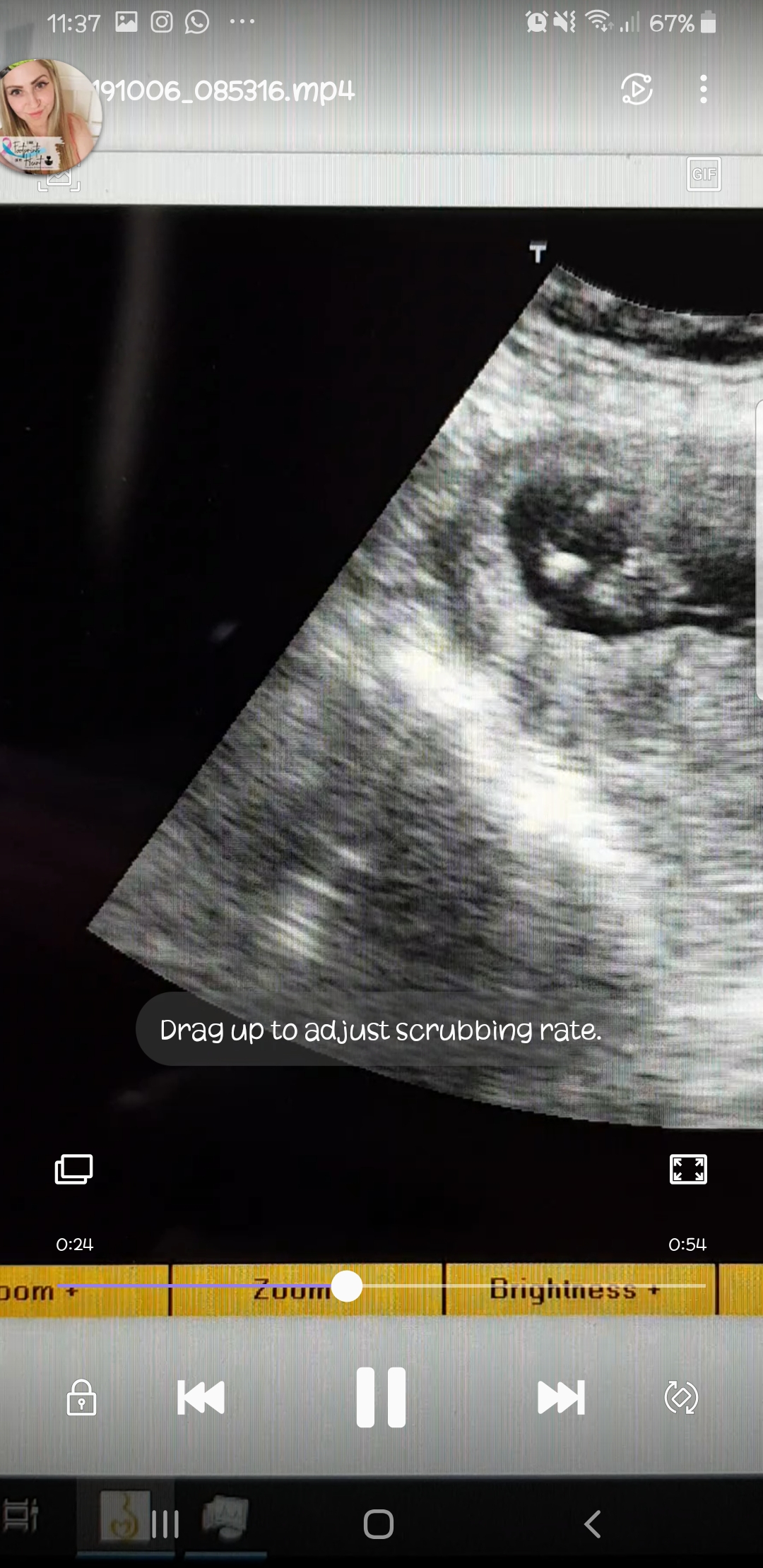 Name:  Screenshot_20191006-113739_Video Player.jpg
Views: 323
Size:  965.2 KB