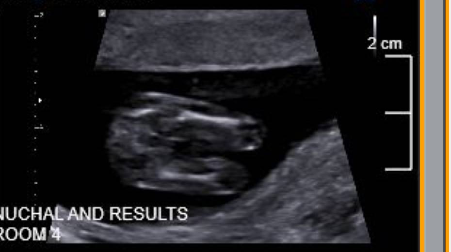 Name:  Screenshot_20191109-213323~3.jpg
Views: 1182
Size:  30.4 KB