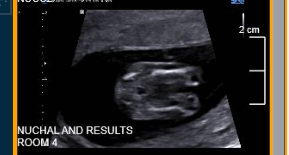 Name:  Screenshot_20191109-213253~2.jpg
Views: 966
Size:  35.4 KB