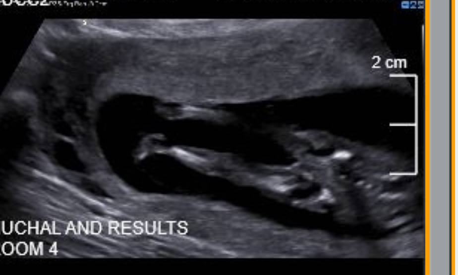 Name:  Screenshot_20191109-213448~2.jpg
Views: 1075
Size:  38.8 KB
