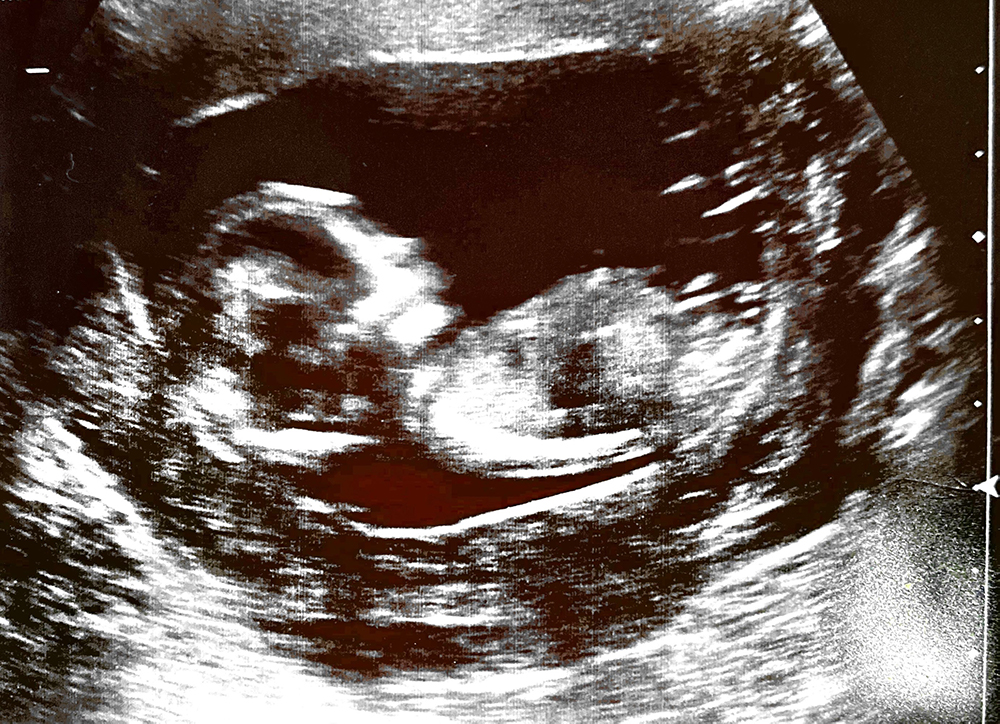 Name:  Scan 3 Jan 2020 at 14.46 page 2.jpg
Views: 417
Size:  701.9 KB