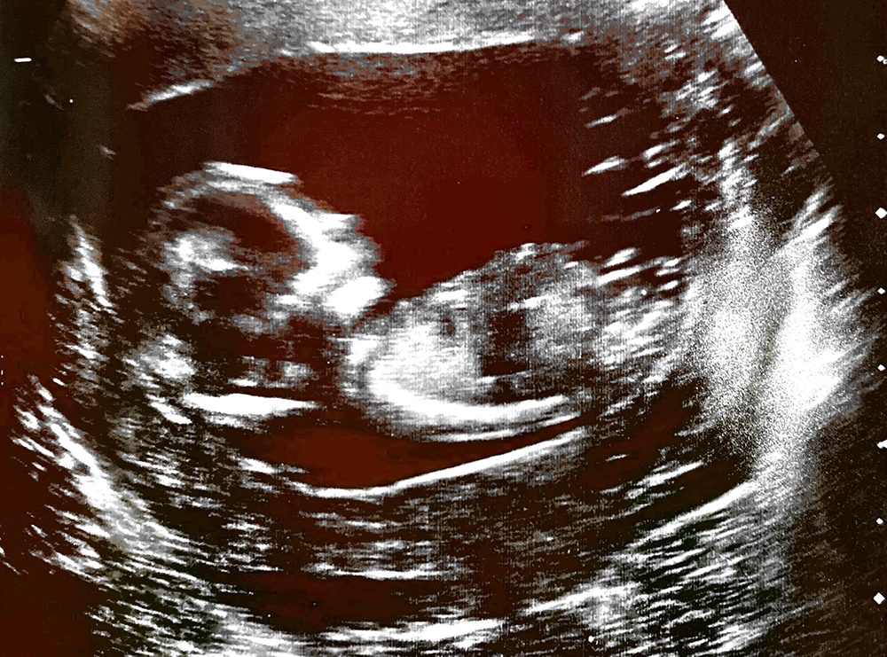 Name:  Scan 3 Jan 2020 at 14.46 page 3.jpg
Views: 449
Size:  701.3 KB