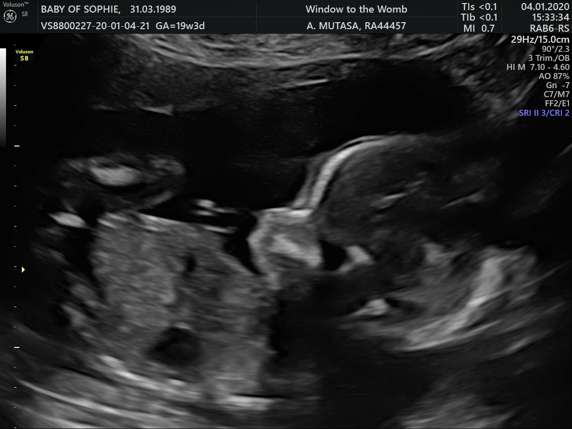 Name:  scan_image3.jpg
Views: 190
Size:  200.5 KB