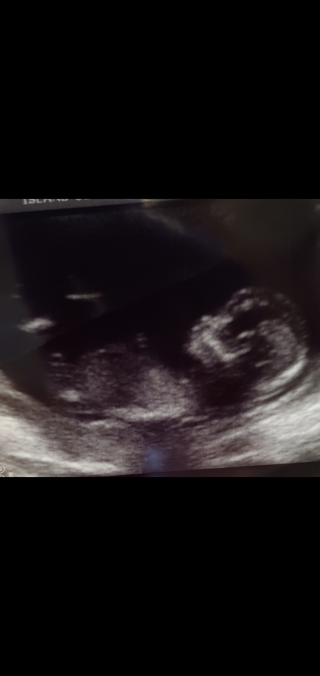 Name:  Screenshot_20200318-115857_Gallery.jpg
Views: 205
Size:  581.1 KB