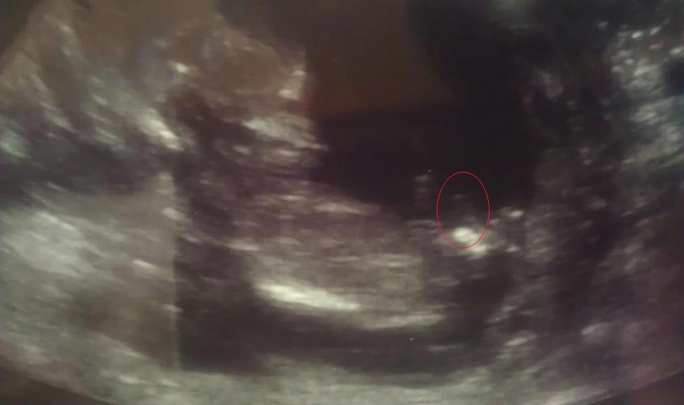 Name:  Baby4.jpg
Views: 227
Size:  56.5 KB