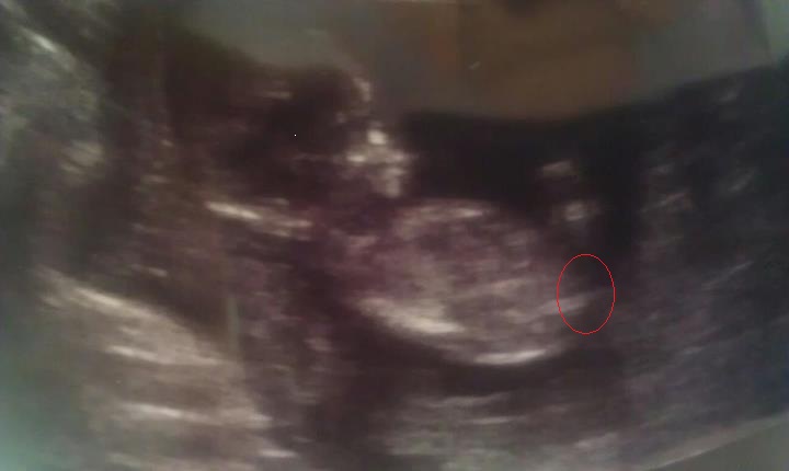 Name:  Baby5.jpg
Views: 224
Size:  31.7 KB