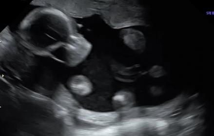 Name:  baby 1.jpg
Views: 243
Size:  11.5 KB
