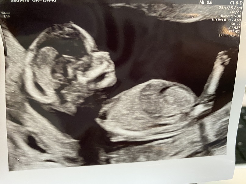 Name:  Baby 4 - 13w4d 3.jpg
Views: 620
Size:  148.6 KB
