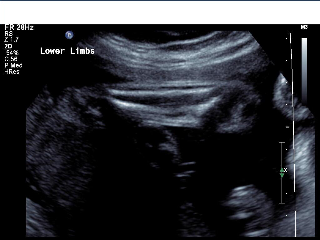 Name:  lower limbs.jpg
Views: 2589
Size:  62.5 KB