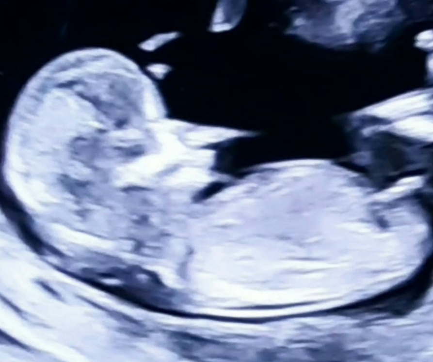 Name:  Screenshot_20220127-152605_Gallery.jpg
Views: 236
Size:  112.2 KB