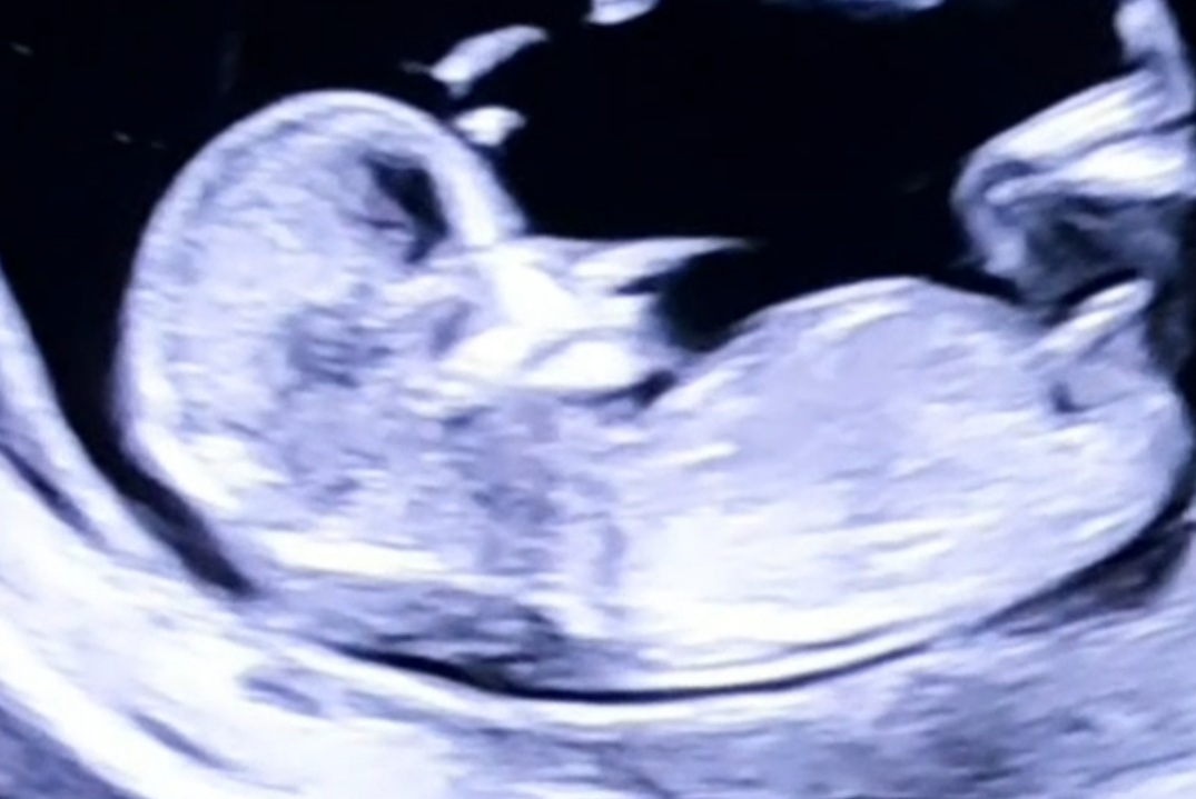 Name:  Screenshot_20220130-133751_Gallery.jpg
Views: 236
Size:  121.0 KB