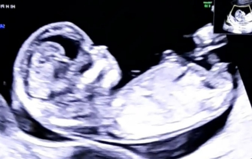 Name:  Screenshot_20220131-175043_Gallery.jpg
Views: 199
Size:  89.9 KB