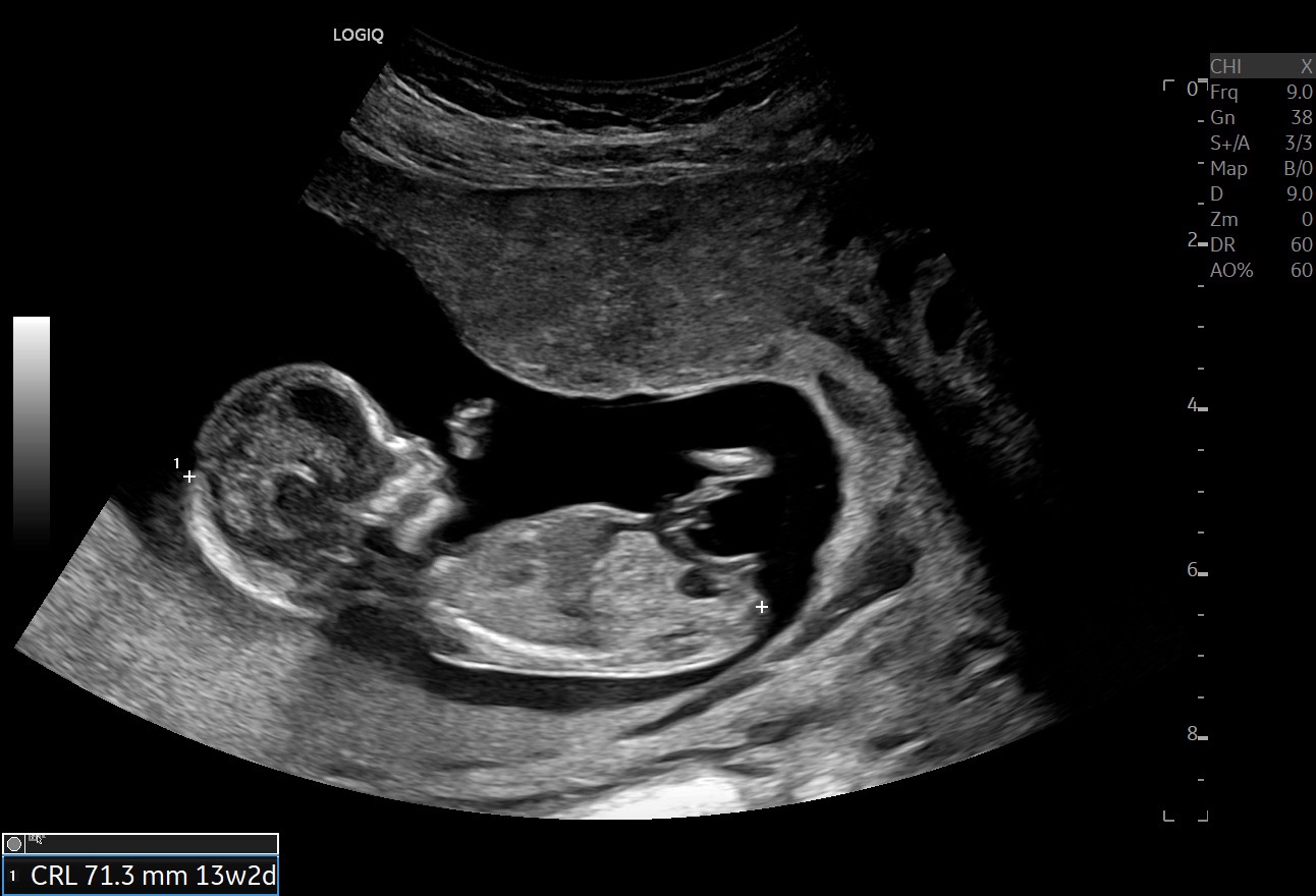 Name:  this baby.jpeg
Views: 909
Size:  334.9 KB