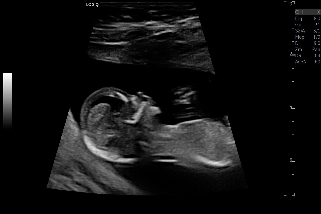 Name:  This baby 2.jpeg
Views: 855
Size:  195.7 KB