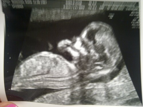 Name:  baby.jpg
Views: 96
Size:  29.2 KB