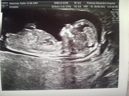 Name:  baby2.jpg
Views: 123
Size:  35.7 KB