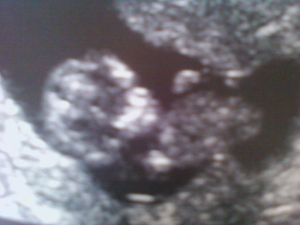 Name:  scan.jpg
Views: 2104
Size:  55.3 KB