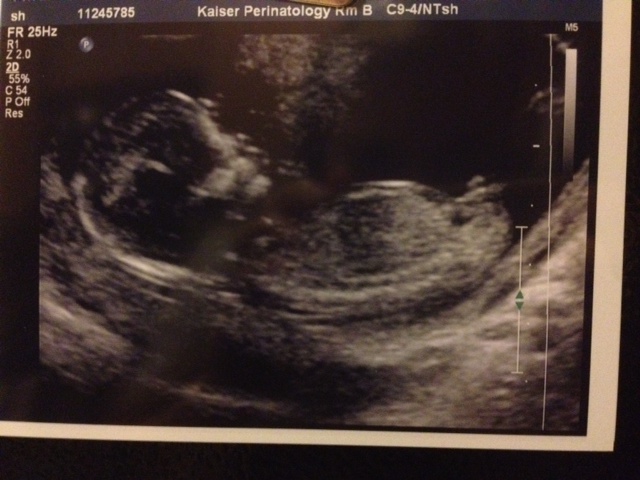 Name:  babyus.JPG
Views: 180
Size:  107.3 KB