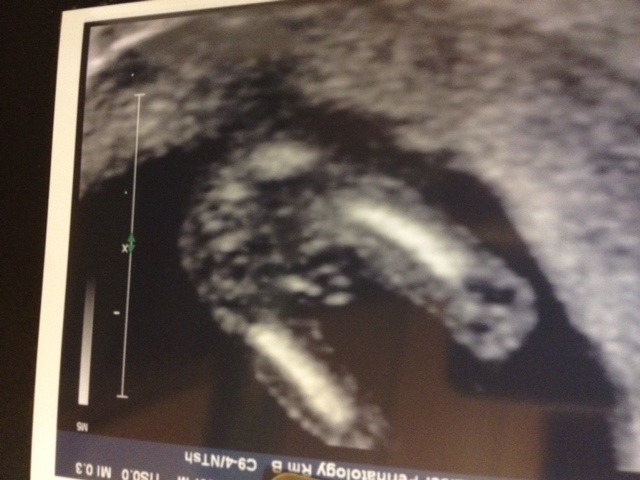 Name:  babyus2.JPG
Views: 170
Size:  94.9 KB