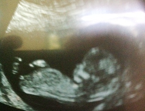 Name:  baby.JPG
Views: 371
Size:  57.1 KB