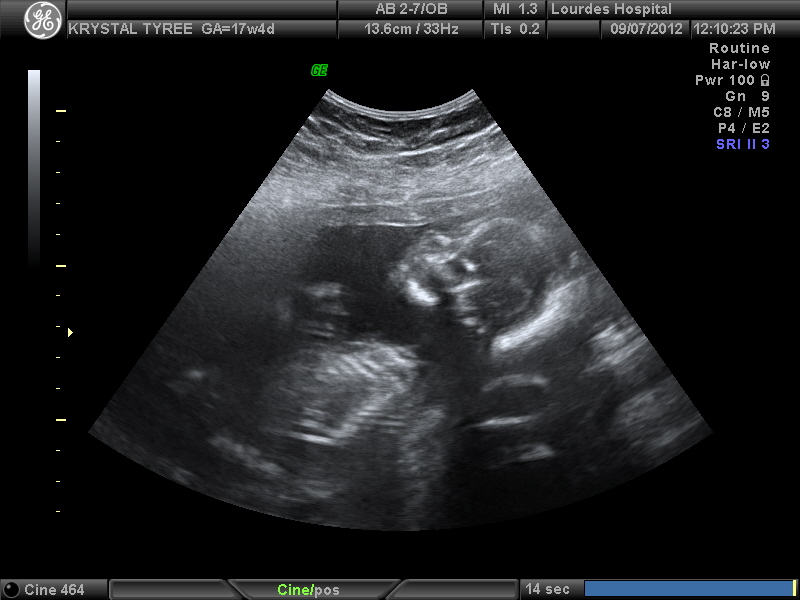 Name:  profile.jpg
Views: 124
Size:  125.7 KB