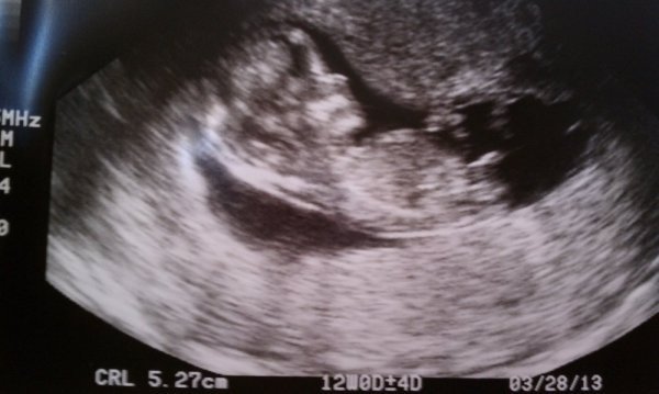 Name:  babypic1.jpg
Views: 14946
Size:  35.1 KB