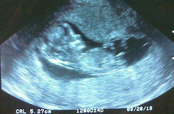Name:  babypic2.jpg
Views: 1955
Size:  54.8 KB