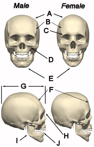 Name:  skull1.jpg
Views: 114
Size:  29.7 KB