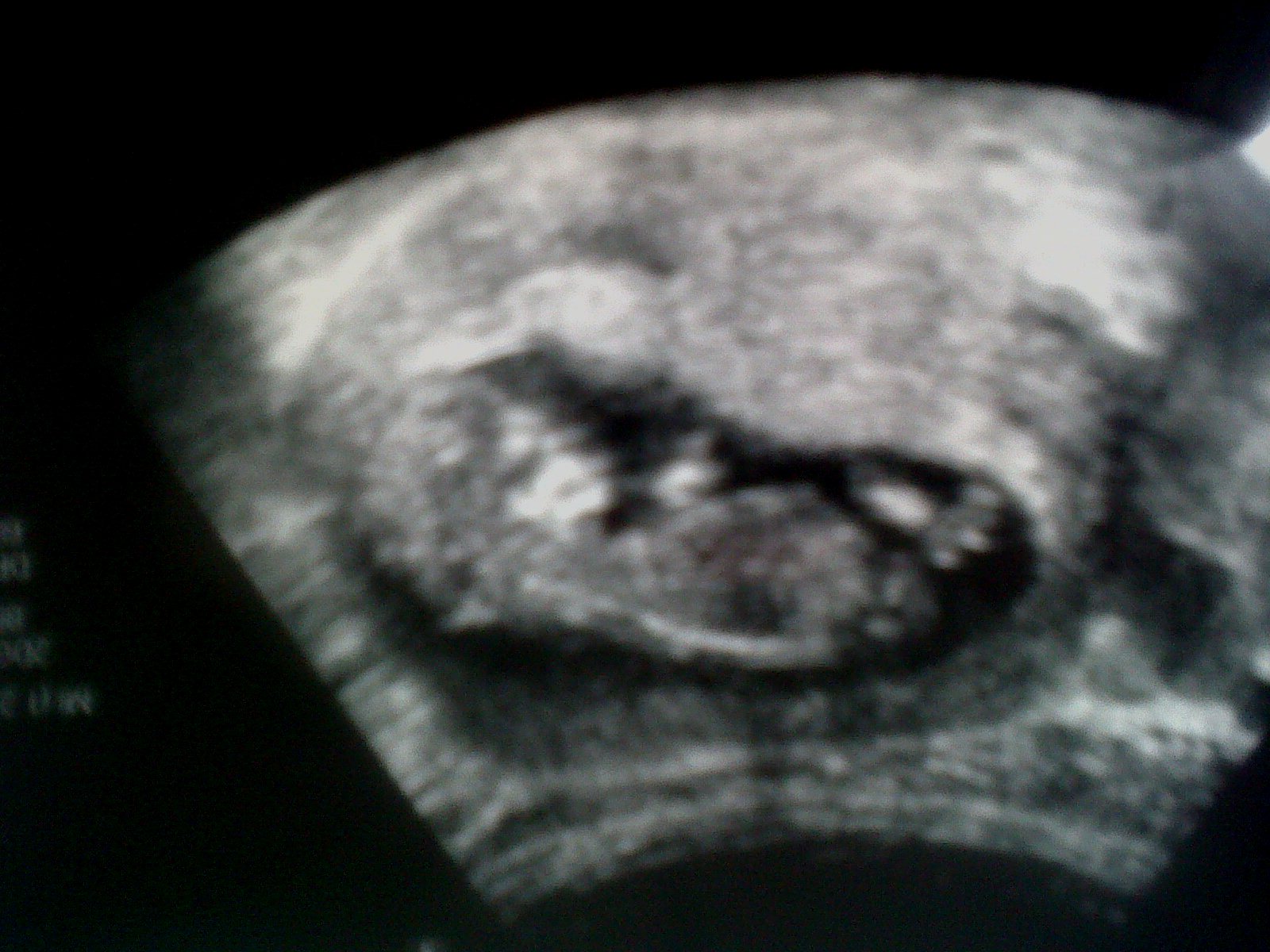 Name:  IMG03570-20120924-1619.jpg
Views: 196
Size:  286.3 KB