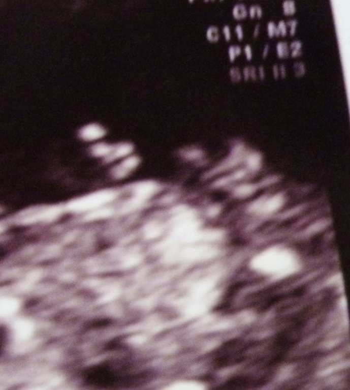 Name:  Baby # 4 (4) - Copy.JPG
Views: 516
Size:  256.9 KB