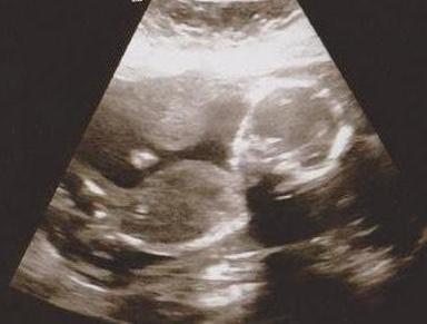 Name:  lunapic_134860476794314_9.jpg
Views: 359
Size:  20.4 KB