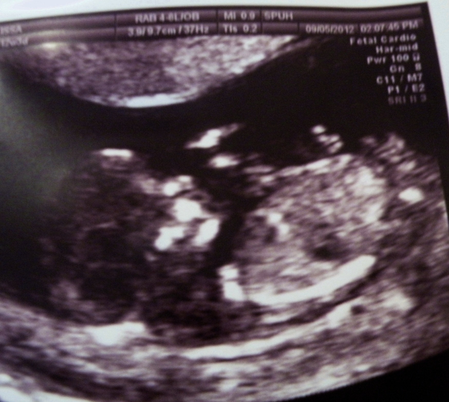 Name:  Baby # 4 (4).JPG
Views: 244
Size:  493.9 KB