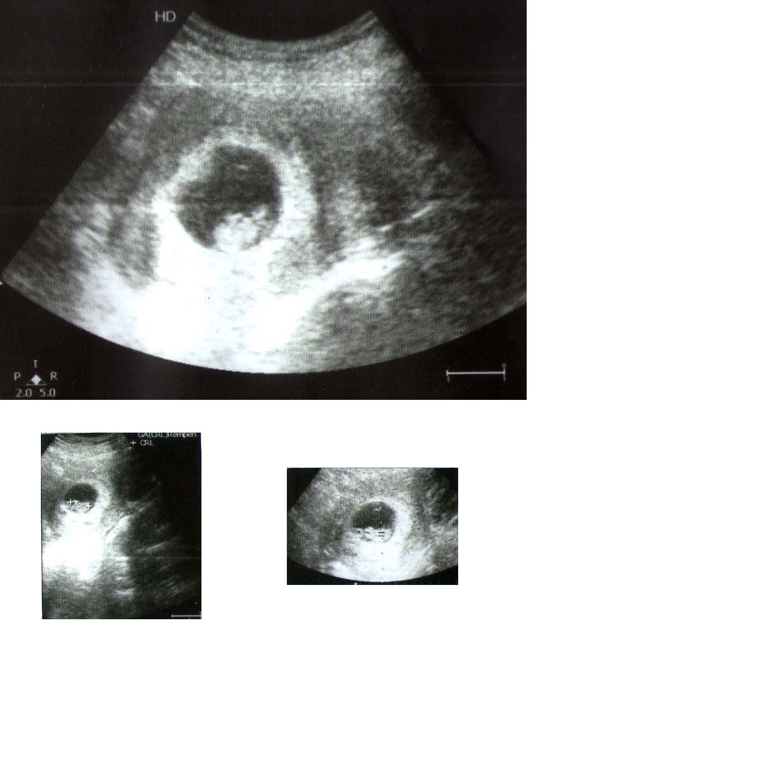 Name:  scan.jpg
Views: 268
Size:  131.9 KB