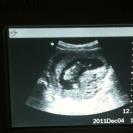 Name:  Haley sonogram April 2013 baby 2.jpg
Views: 114
Size:  4.0 KB