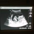 Name:  Haley sonogram April 2013 baby 3.jpg
Views: 149
Size:  14.8 KB