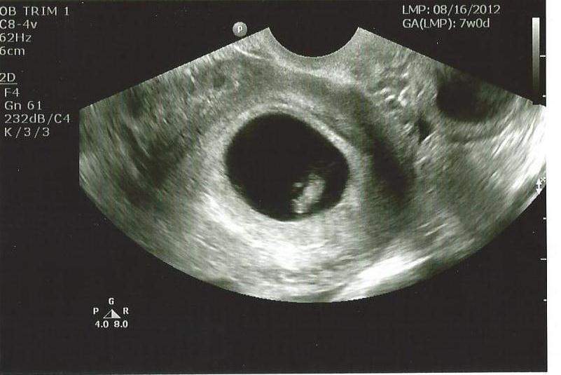 Name:  baby7weeks.jpg
Views: 10481
Size:  50.9 KB