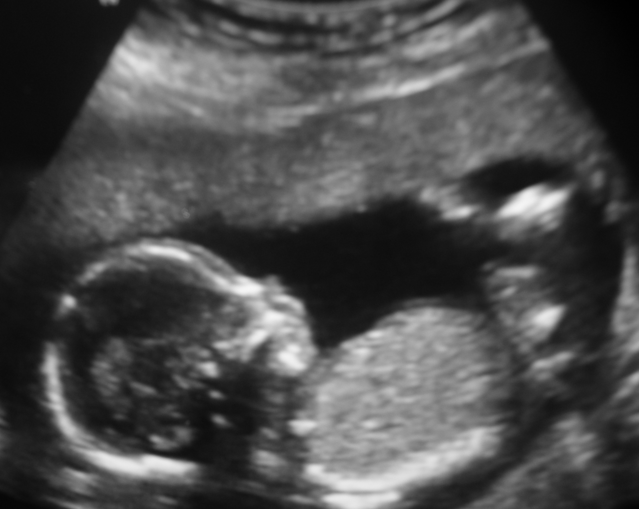 Name:  Baby #4.JPG
Views: 222
Size:  955.0 KB