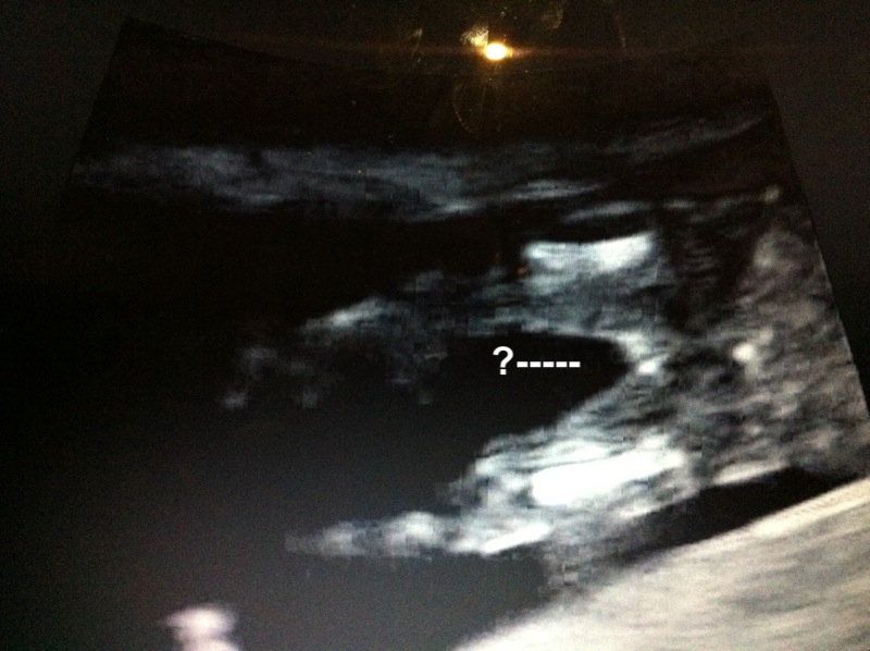 Name:  Baby 148.JPG
Views: 195
Size:  126.9 KB