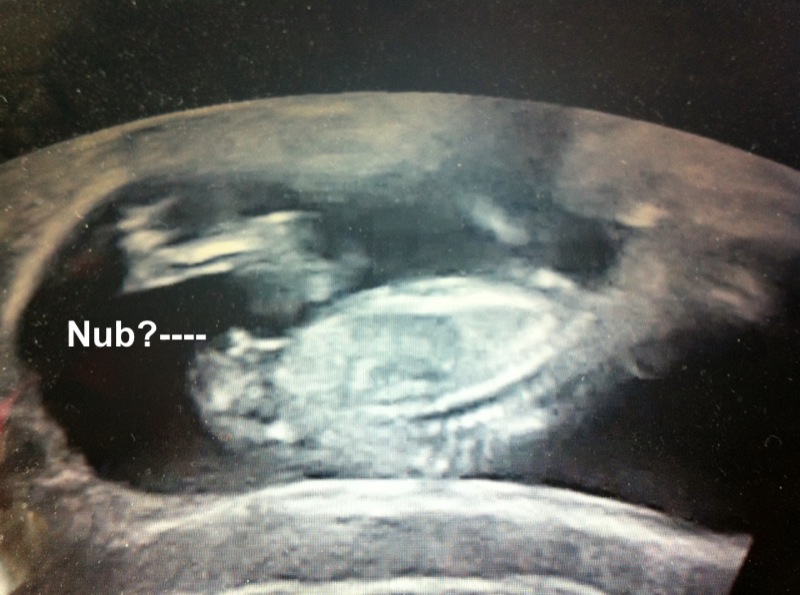 Name:  Baby 146.JPG
Views: 191
Size:  127.3 KB