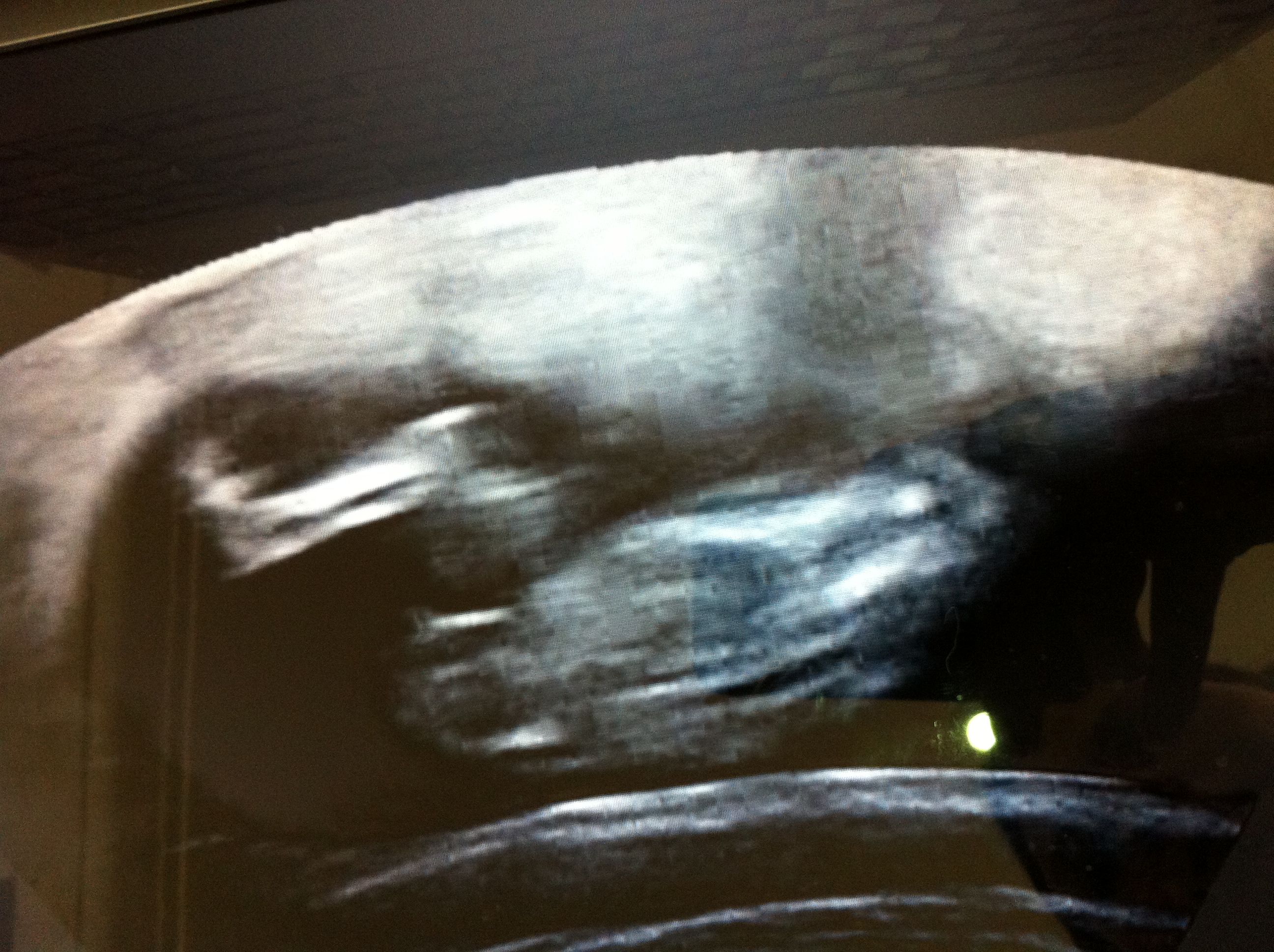 Name:  Baby 025.JPG
Views: 168
Size:  1.90 MB