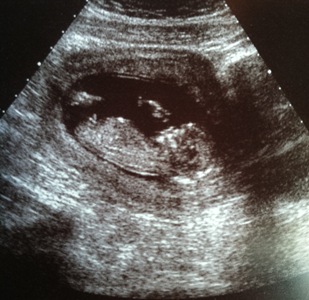 Name:  Baby1.JPG
Views: 107
Size:  39.0 KB