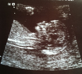 Name:  Baby2.JPG
Views: 121
Size:  37.7 KB