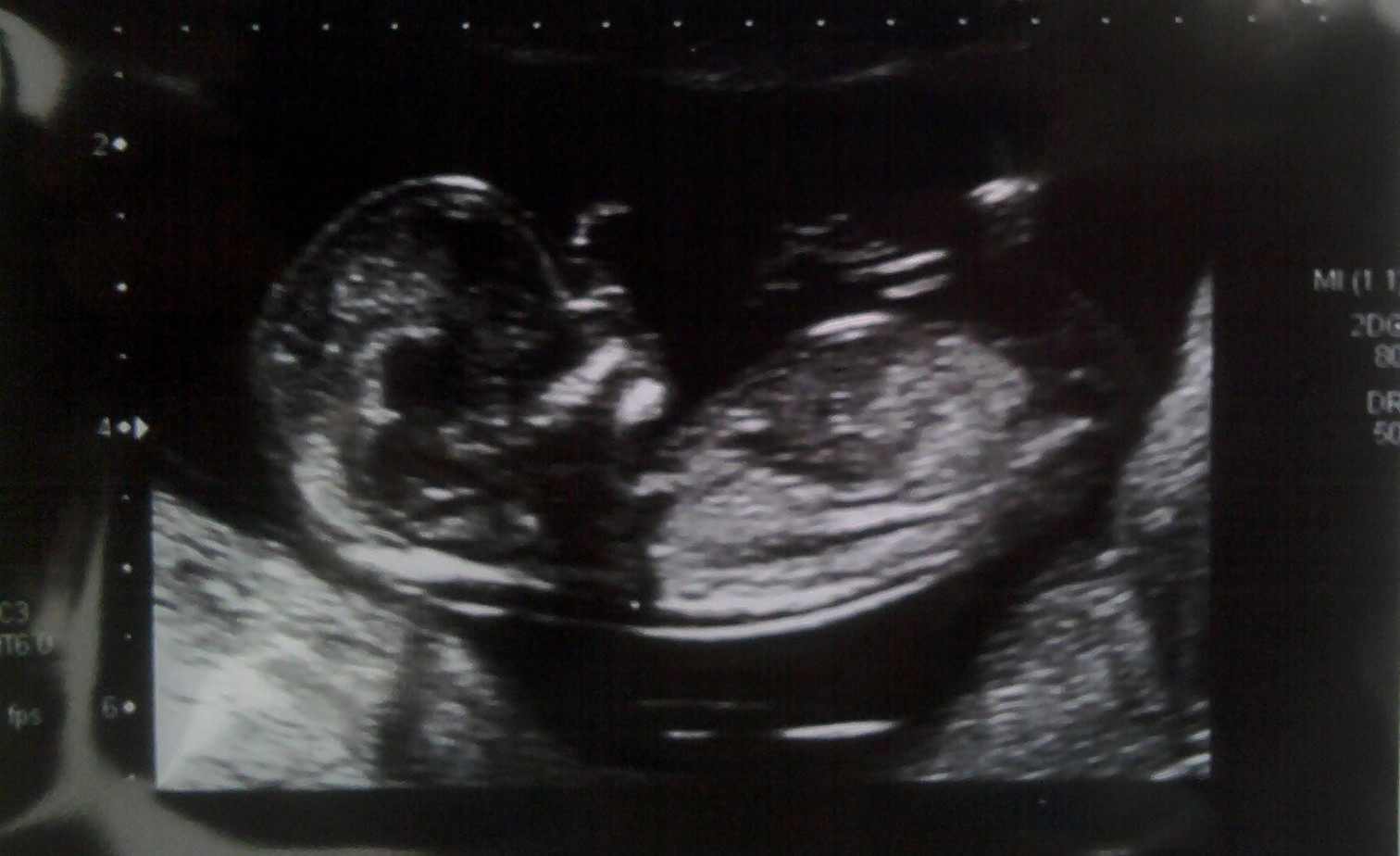 Name:  baby4pic2.JPG
Views: 1452
Size:  205.2 KB