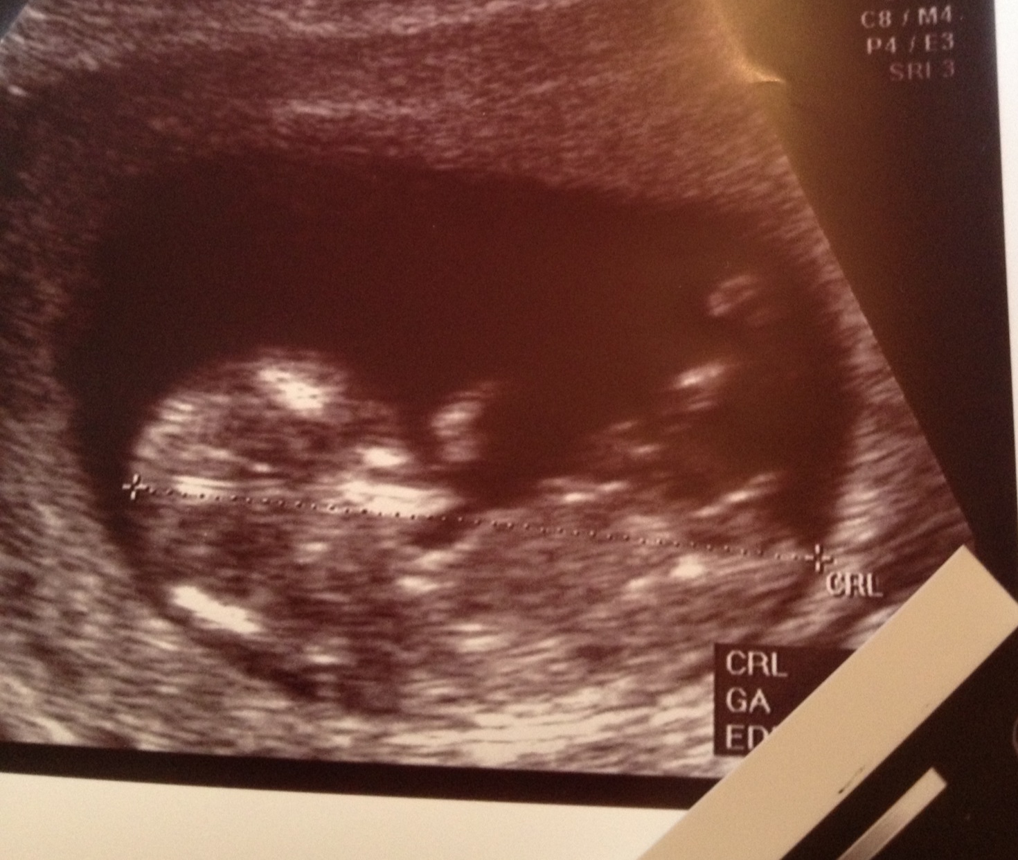 Name:  Nub shot scan.jpg
Views: 446
Size:  373.5 KB