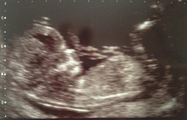 Name:  Baby Seu 12 weeks.1.JPG
Views: 361
Size:  79.9 KB