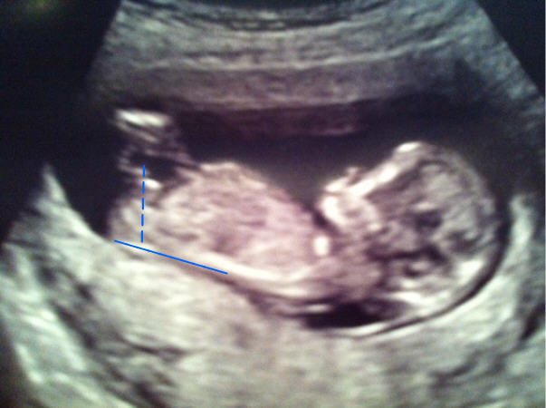 Name:  baby.jpg
Views: 90
Size:  38.1 KB