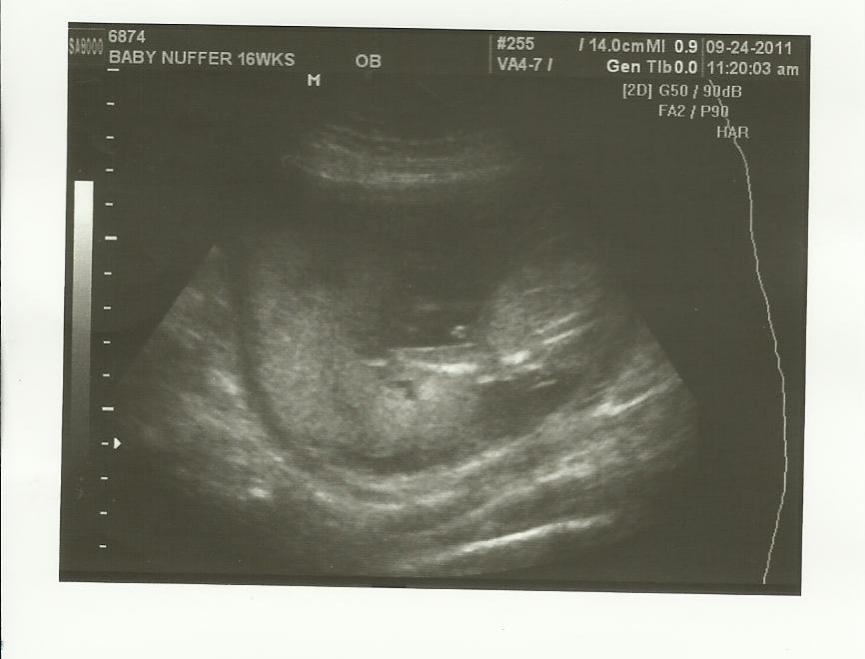 Name:  Its a boy!.jpg
Views: 161
Size:  43.6 KB